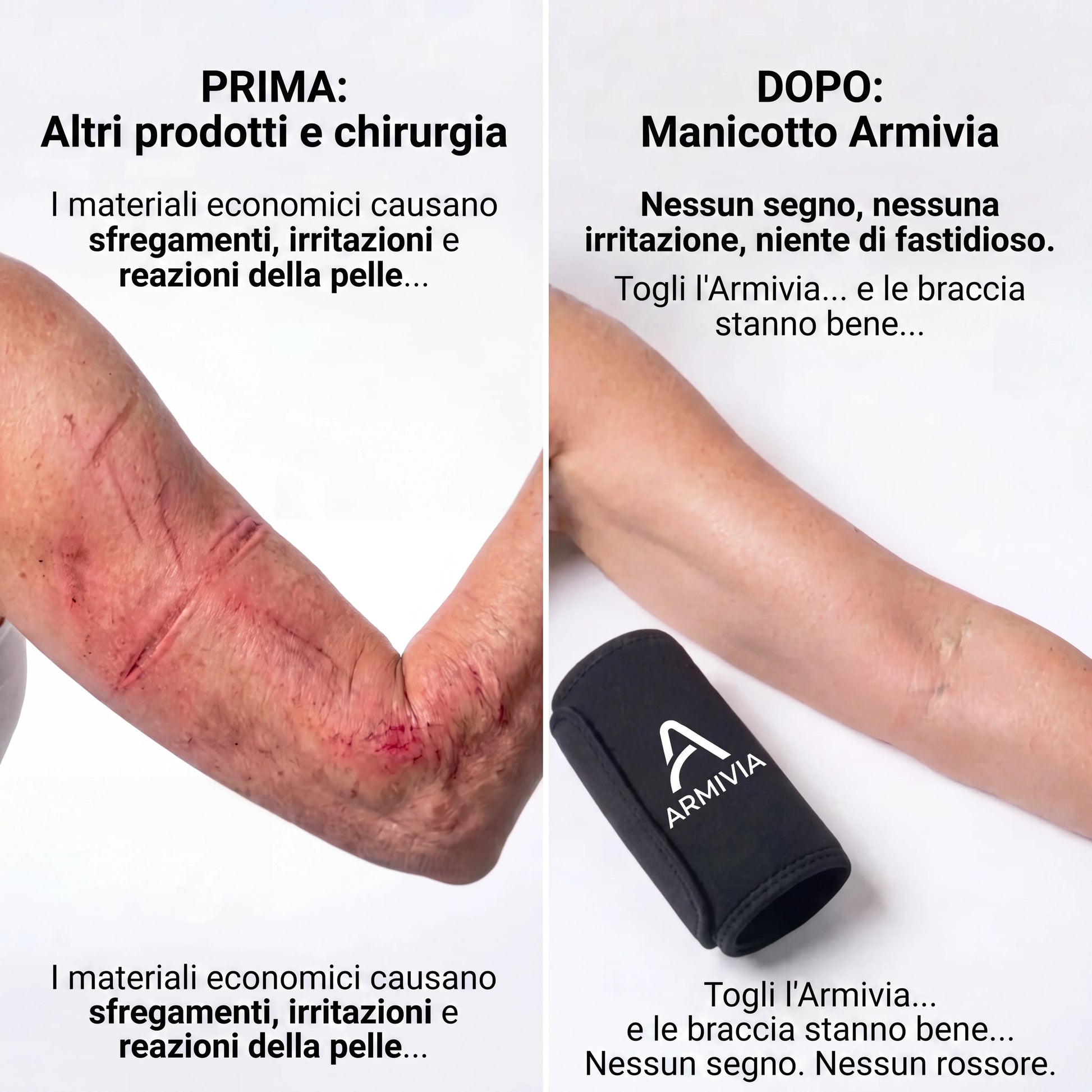 Prima e dopo con il manicotto Armivia